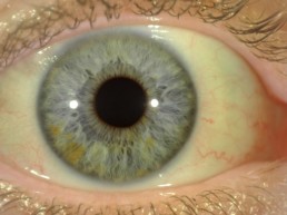 naturheilverfahren-hannover-Augendiagnose-2